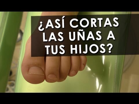 Consejos para cortar las uñas de los niños
