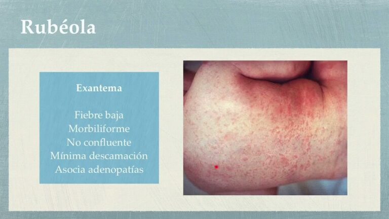 Diagn&oacute;stico de problemas dermatol&oacute;gicos en la infancia