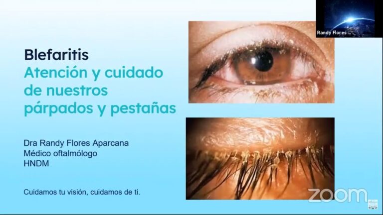 Productos recomendados para la higiene ocular infantil