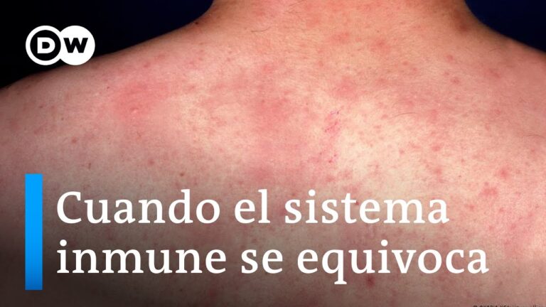 Alimentos desencadenantes de alergias en niños: Guía informativa