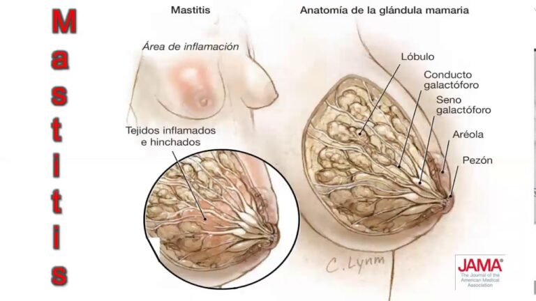 El impacto de los medicamentos en la lactancia